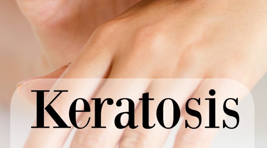 Keratosis Pilaris – Dealing with Chicken Skin
